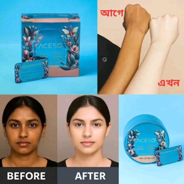 Aceso Body Cream - Image 3